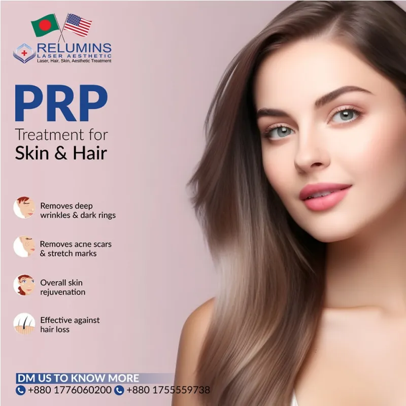 PRP Treatment