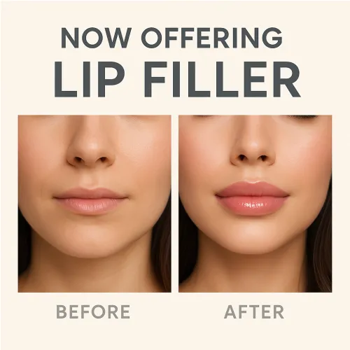 Lip Filler Treatment: