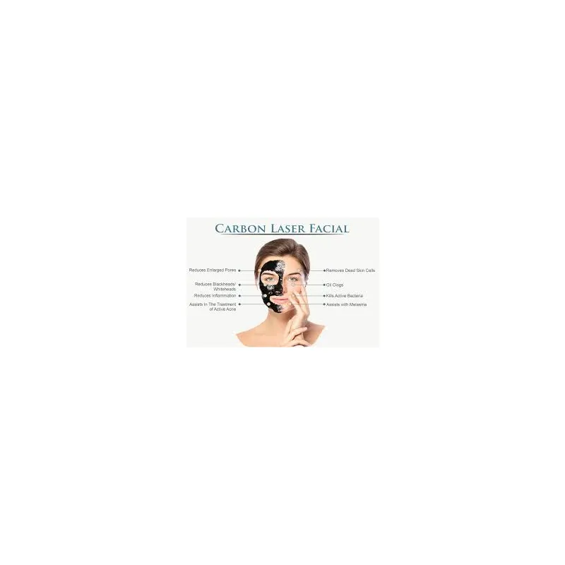 Carbon Facial Treatment