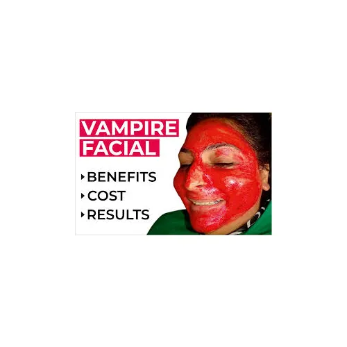 Vampire Facial