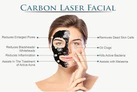 Carbon Facial Treatment